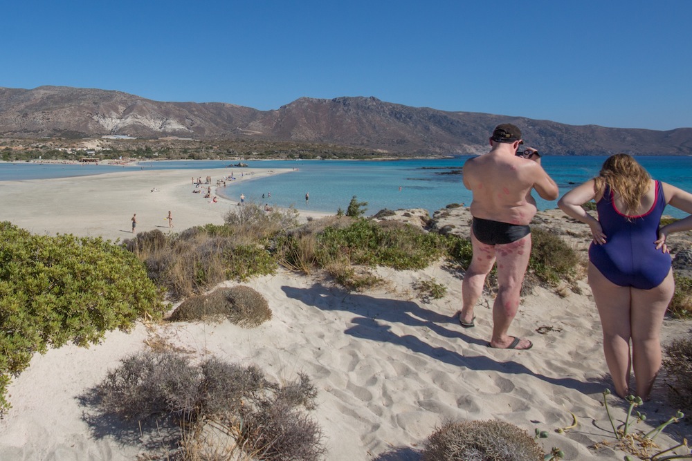 Man with sores on body in Greece